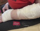  Собака покусала пенсионерку в Красноярске